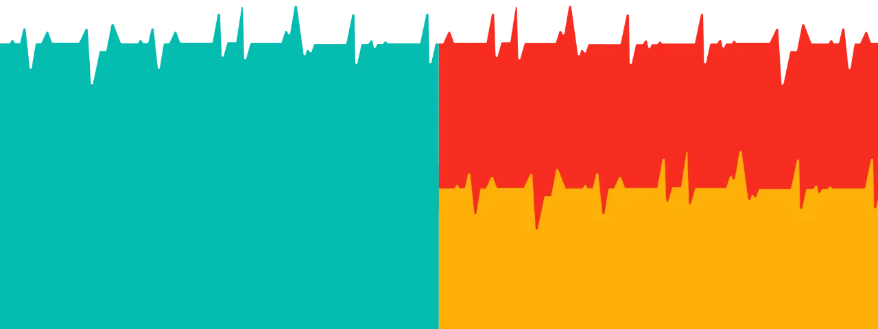 ecg